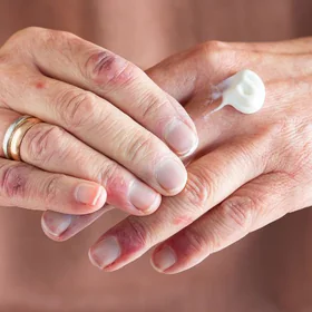 atopijski-dermatitis-pri-odraslih