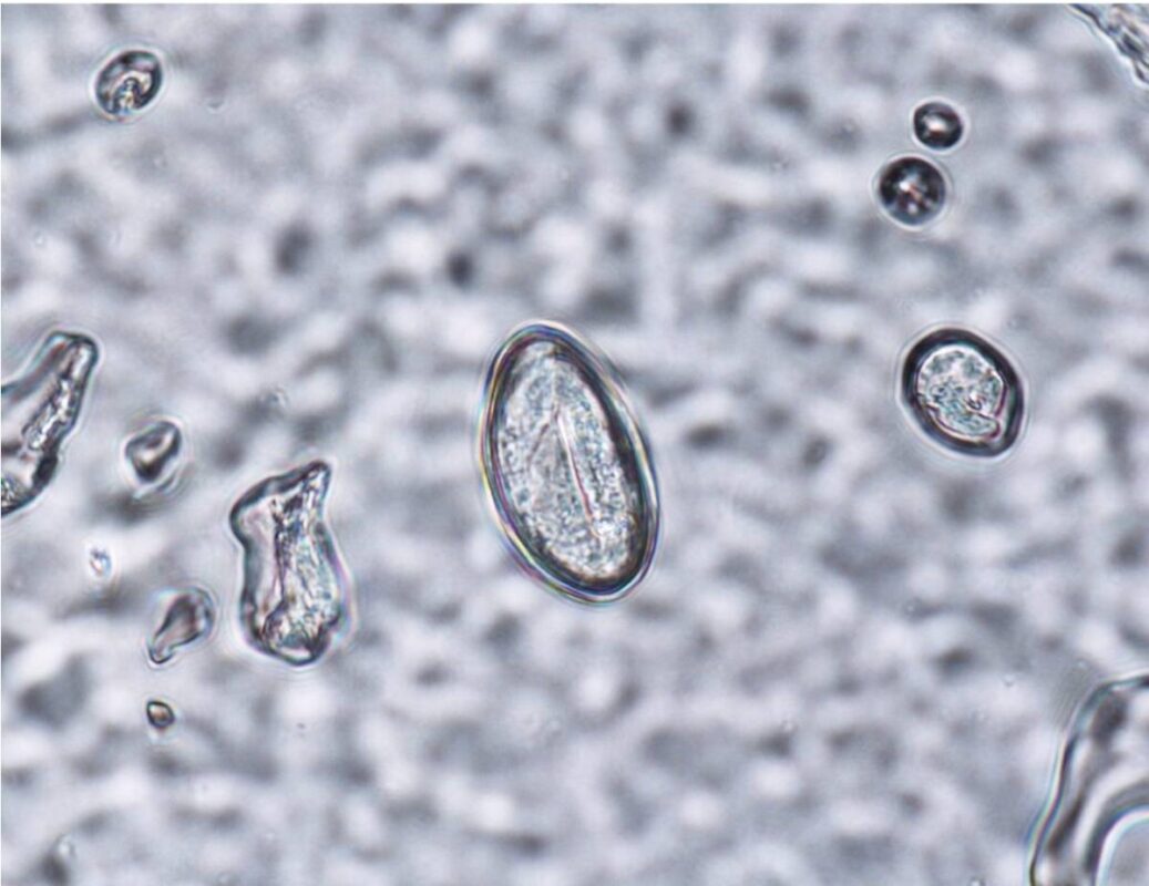 mikroskopska-jajceca-glist