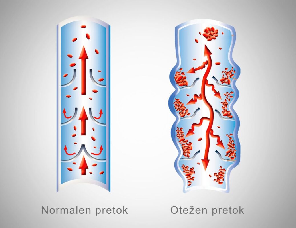 normalen-in-otezen-krvni-pretok