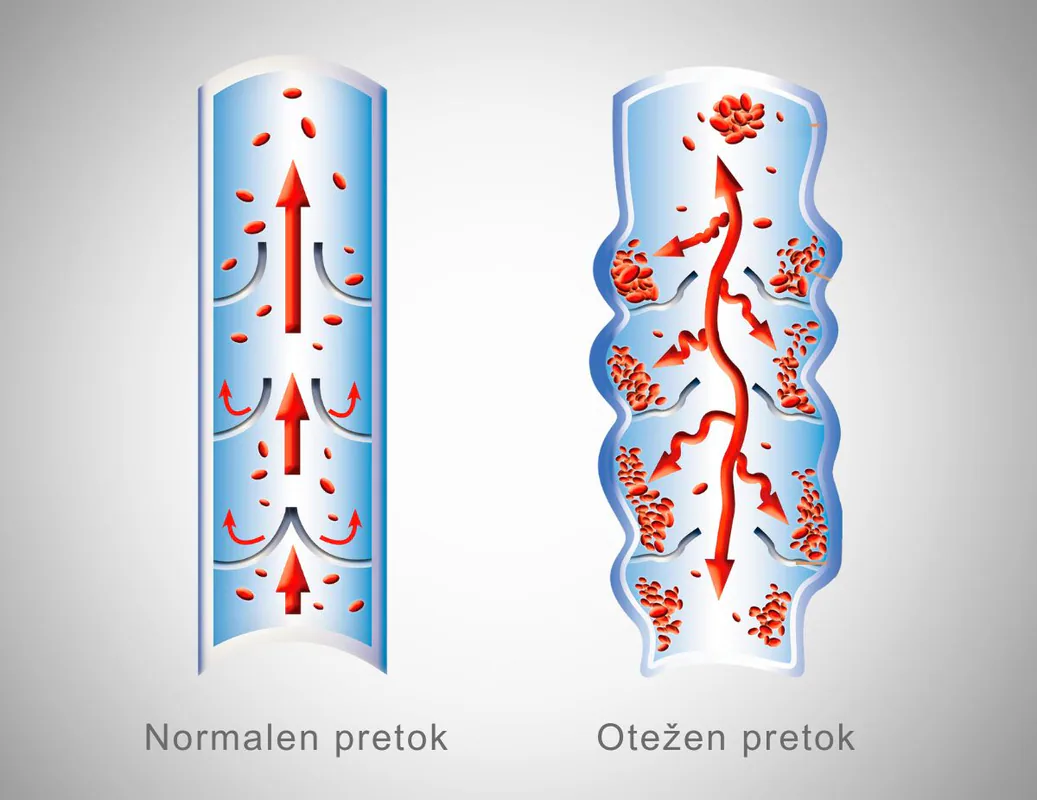 normalen-in-otezen-krvni-pretok